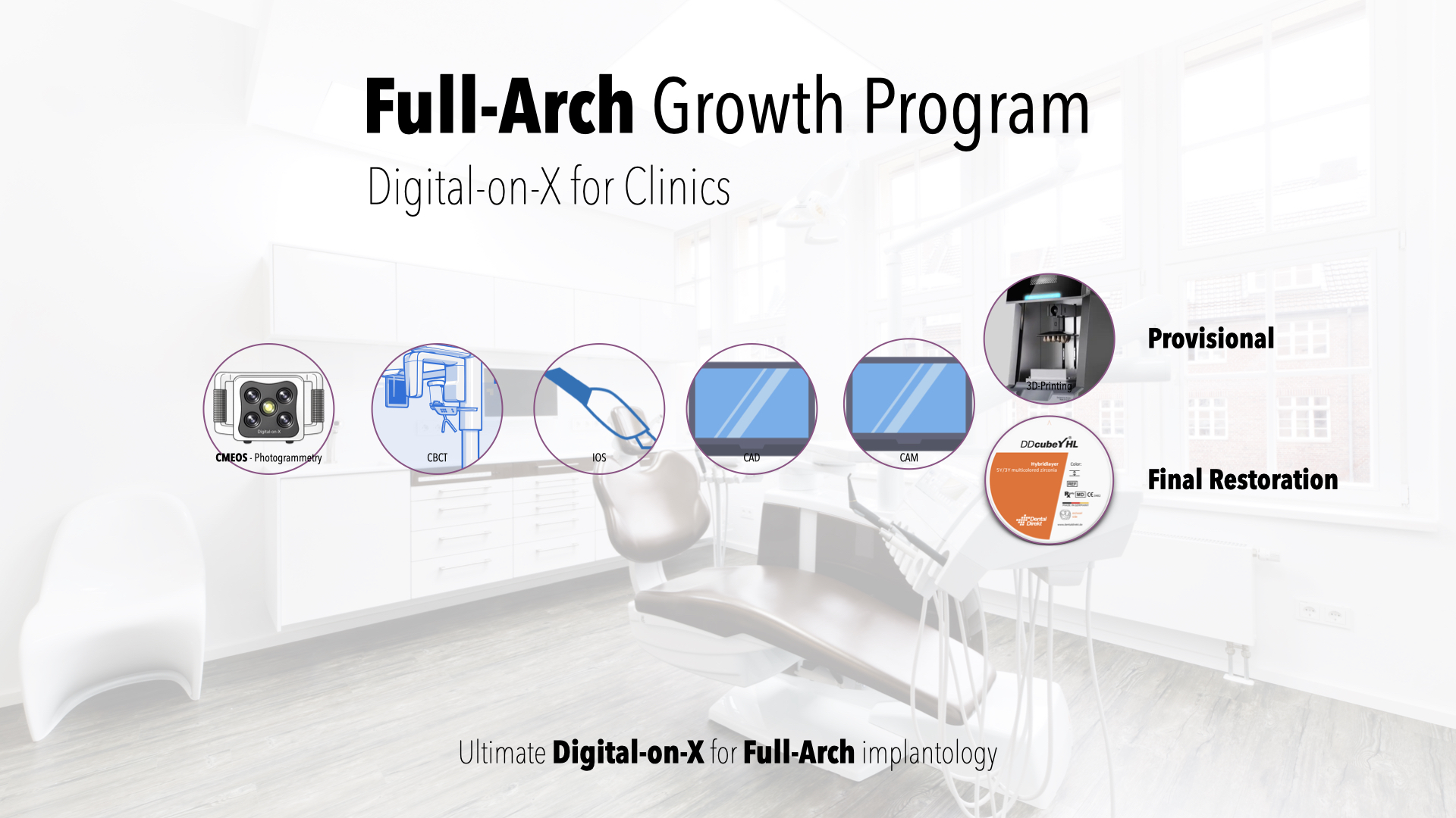 Digital-on-X for Full-Arch implantology